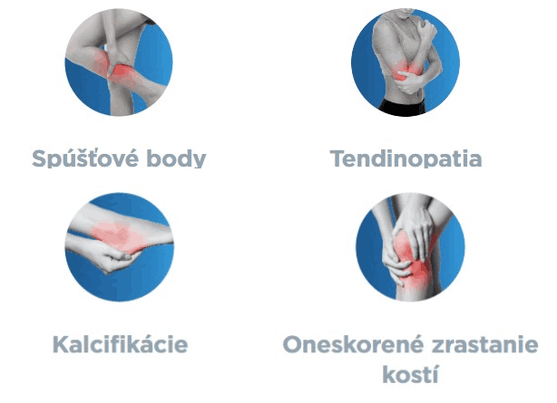Presne cielená regenerácia tkanív